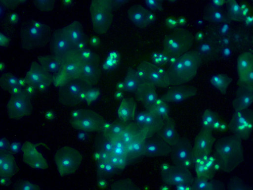 Fluorescence Human Cells Axio Zoom