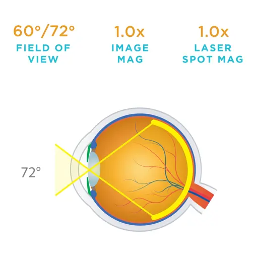 Digital1.0Ximaginglens VDGTL1